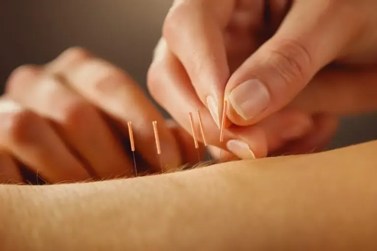 The Role and Significance of TCM Acupuncture in Singapore’s Healthcare Landscape